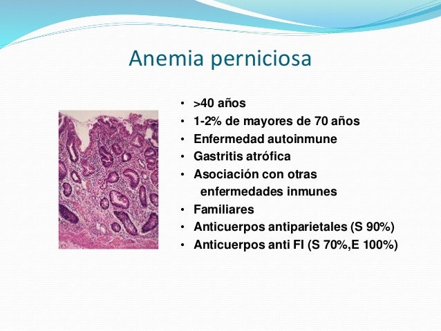 ANEMIA PERNICIOSA AUTOINMUNE PDF